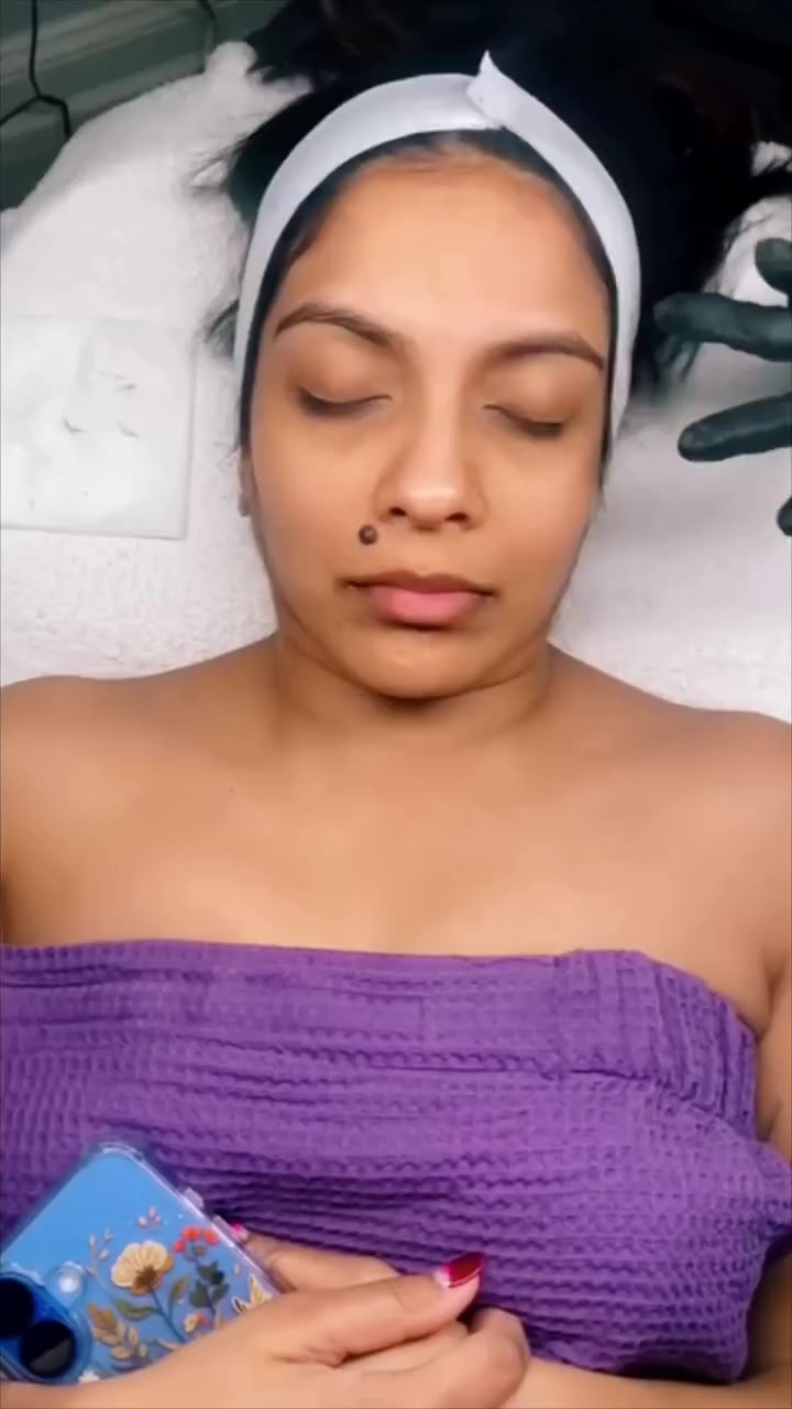 Medical aesthetics treatment at Menon Medispa Millburn NJ