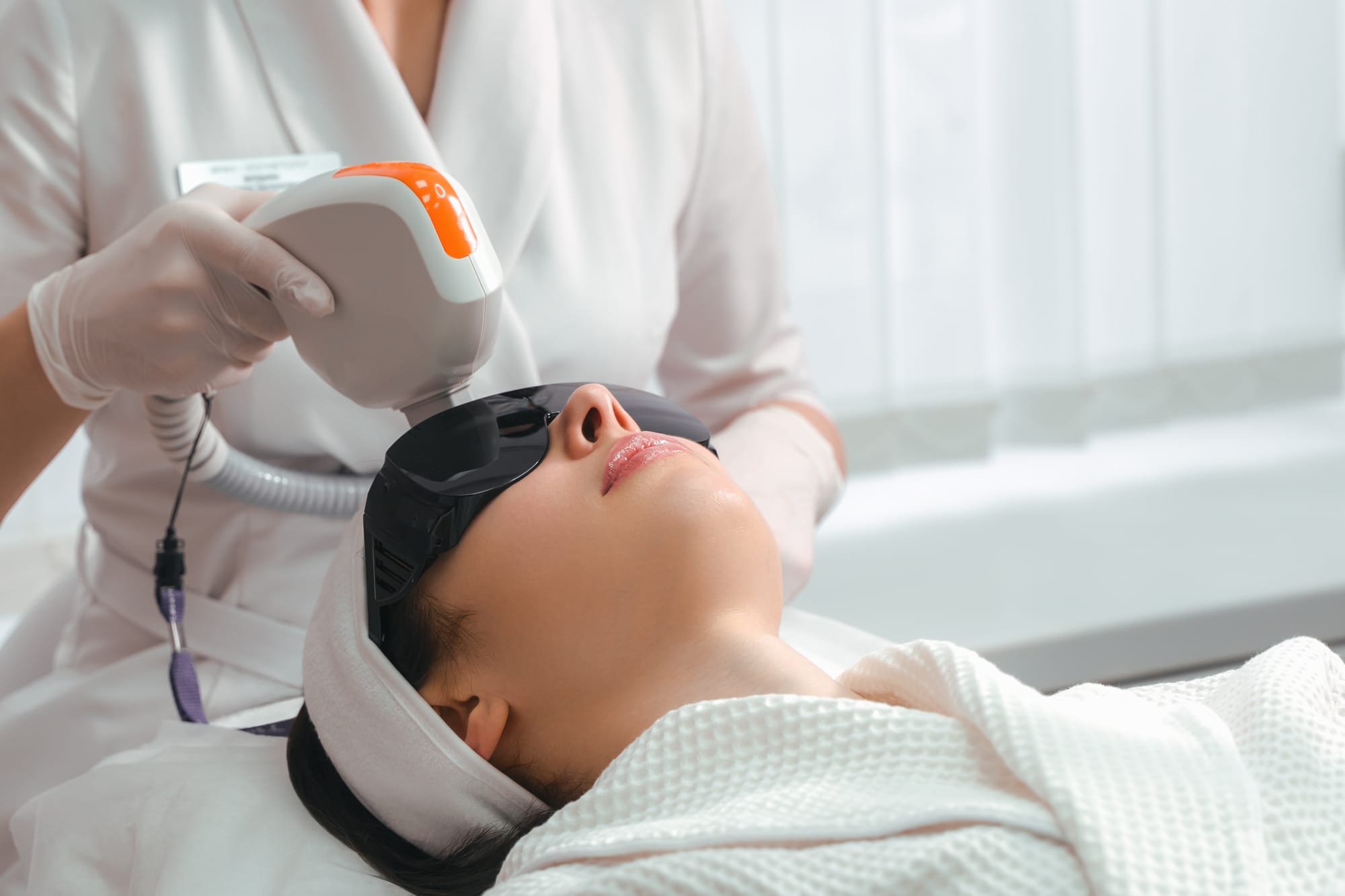 Hyperpigmentation / Photorejuvenation laser treatment