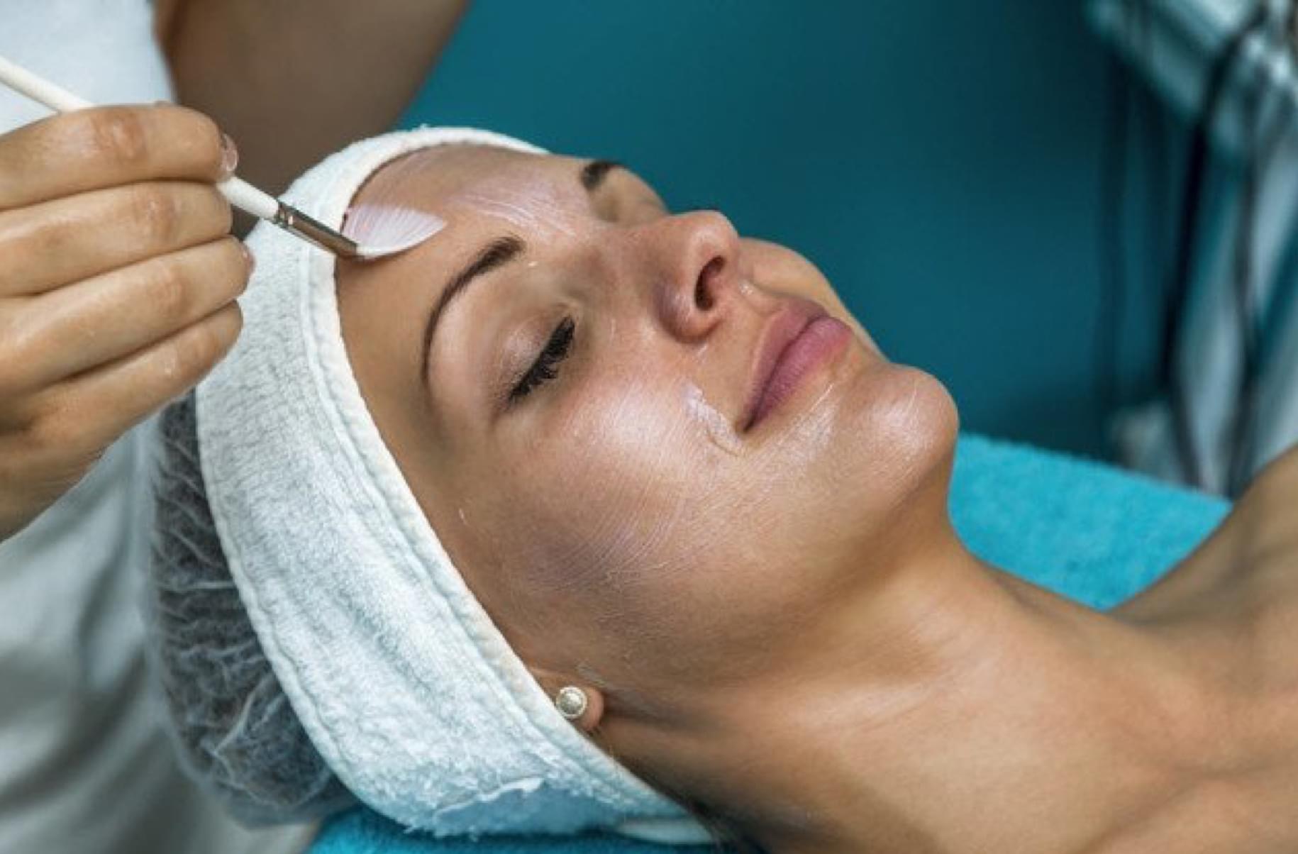 Chemical Peel Facial at Menon Medispa