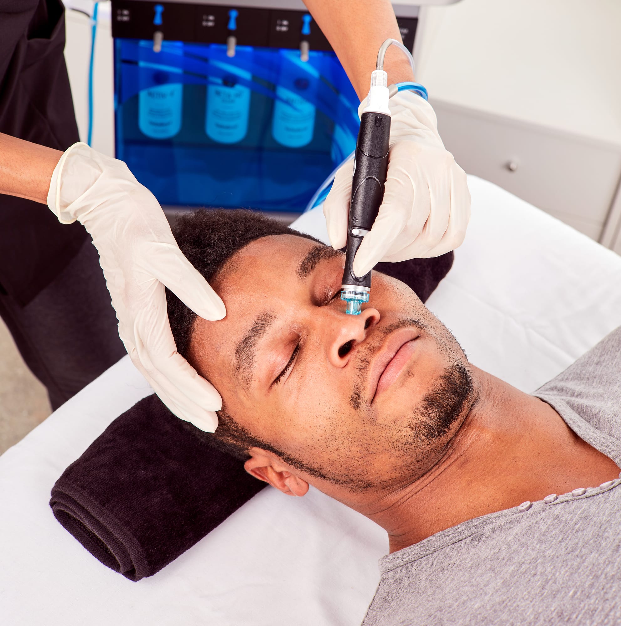 HydraFacial result