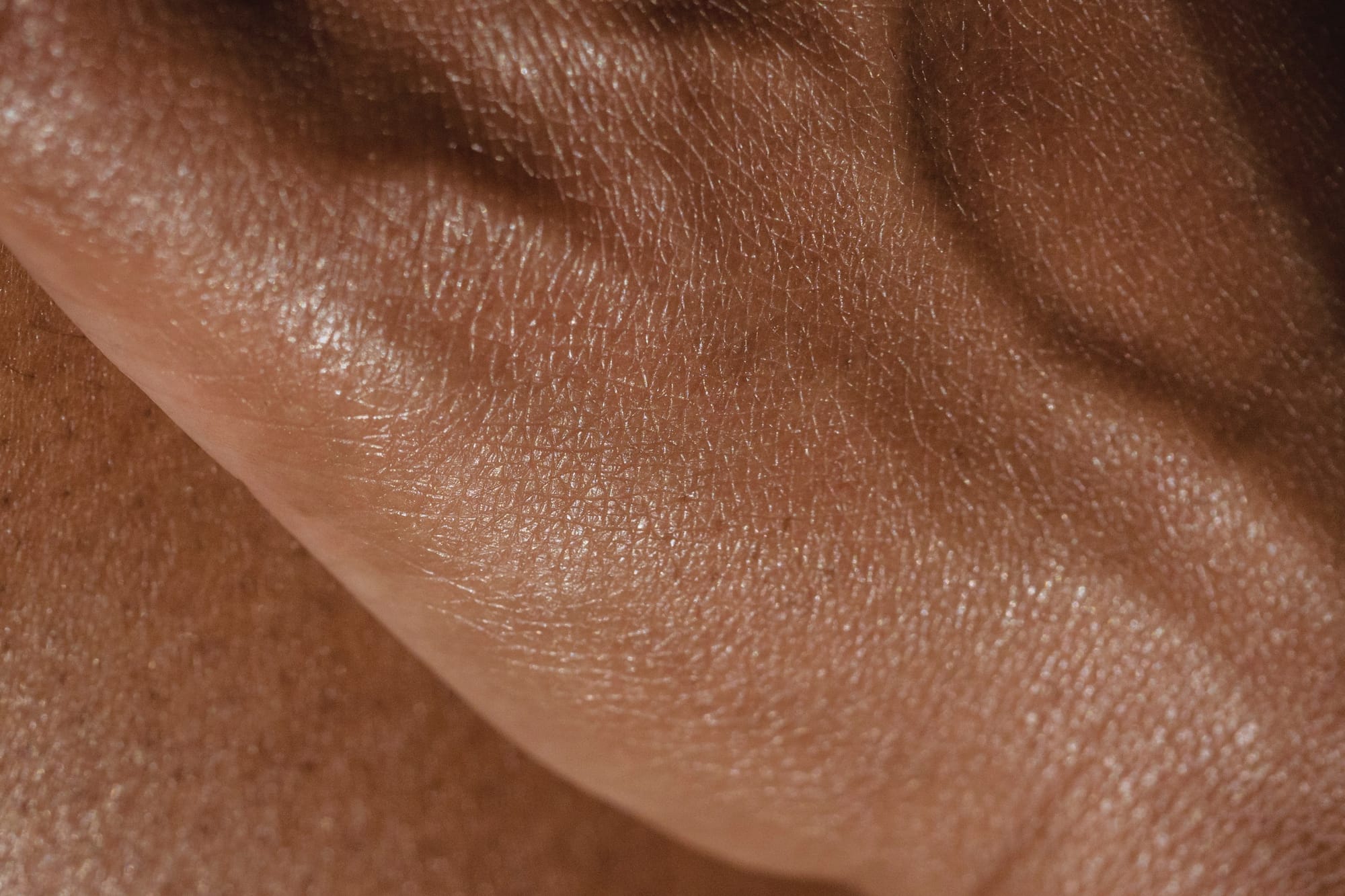 Laser vein and vascular treatment at Menon Medispa in Millburn, NJ