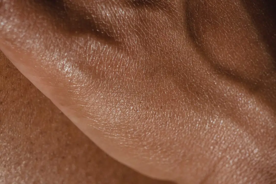 Laser vein and vascular treatment at Menon Medispa in Millburn, NJ