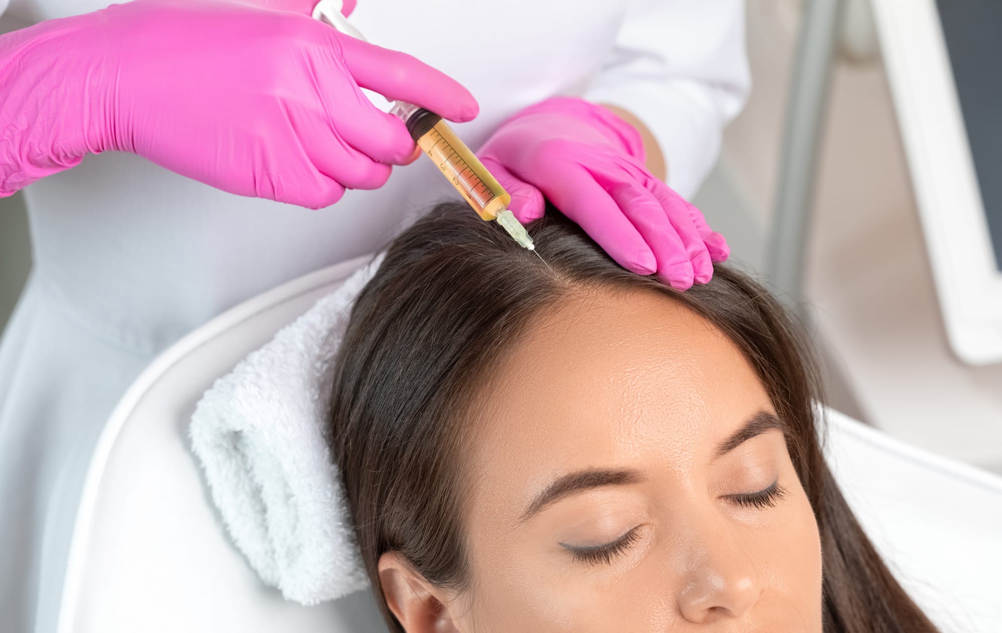 Woman getting hair restoration PRP treatment at Menon Medispa