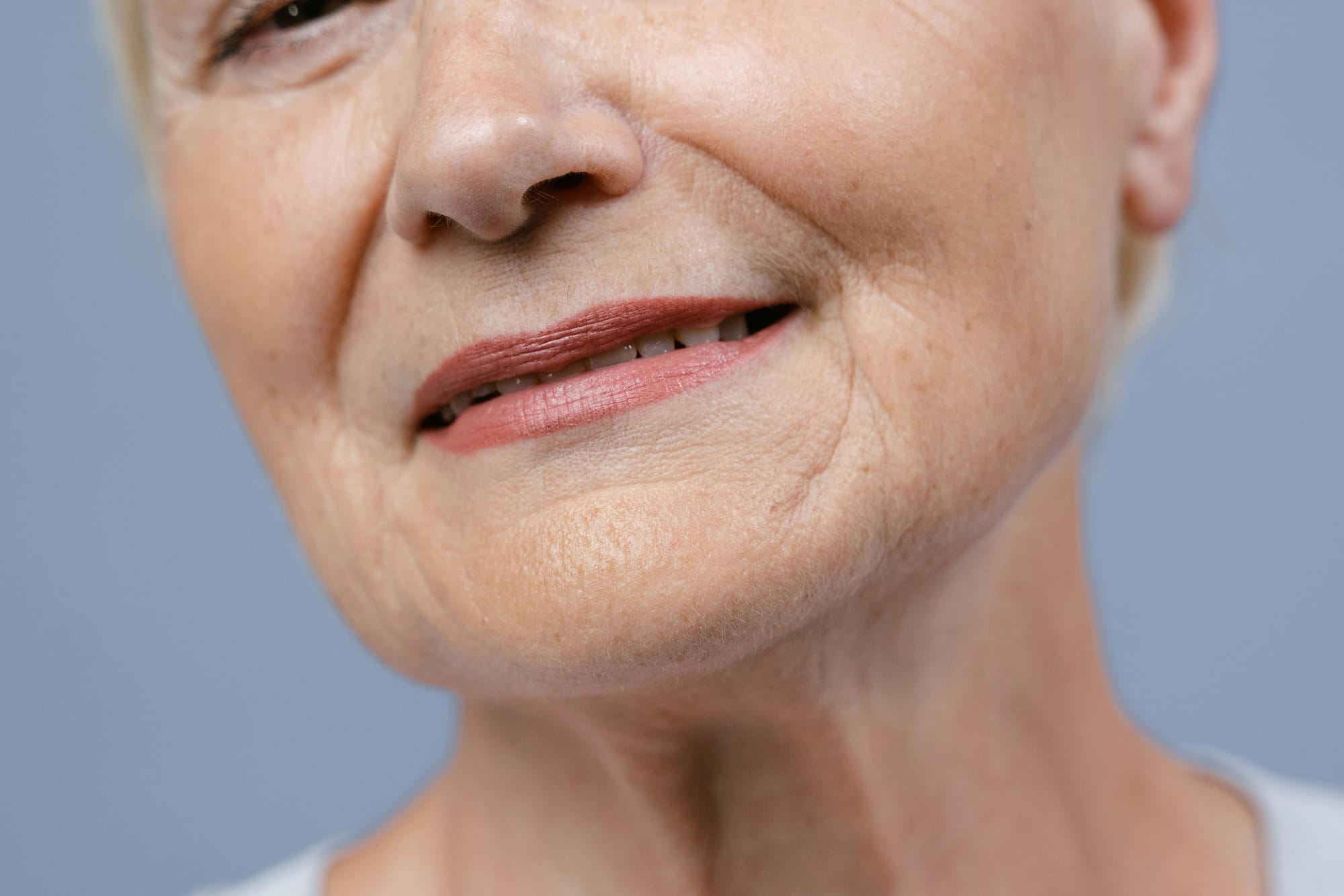 Anti-aging skin concerns addressed at Menon Medispa Millburn NJ