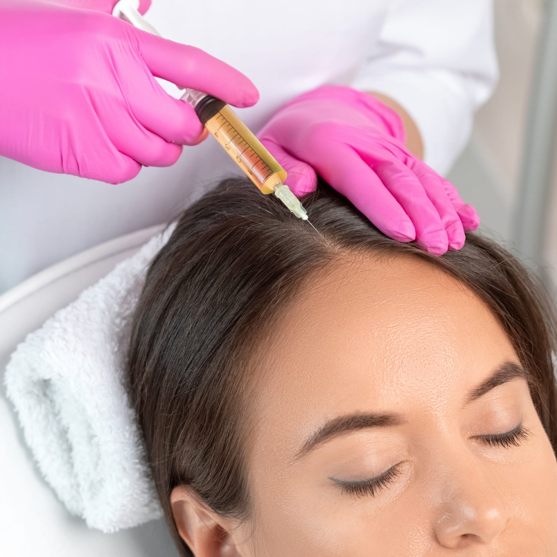 Platelet-Rich Plasma Hair Restoration at Menon Medispa