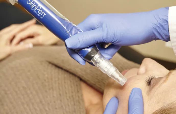 The Complete Guide to Microneedling Therapy and the SkinPen.